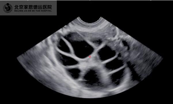 家恩德运：怀不上孩子很着急？